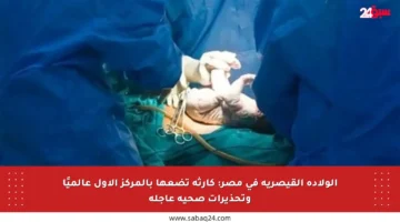 الولادة القيصرية في مصر: كارثة تضعها بالمركز الأول عالميًا وتحذيرات صحية عاجلة